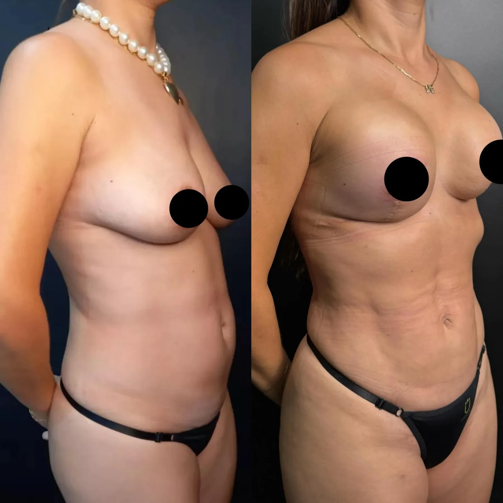 Antes e depois — resultado real