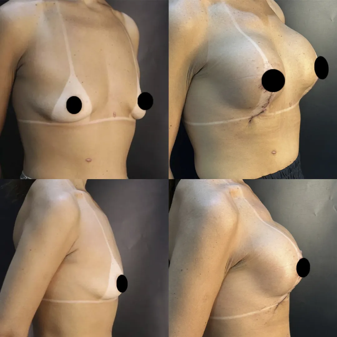 Antes e depois — resultado real