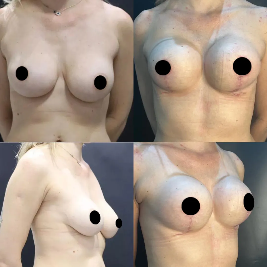 Antes e depois — resultado real